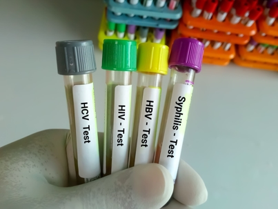 Medical professional holding vials of STD tests.