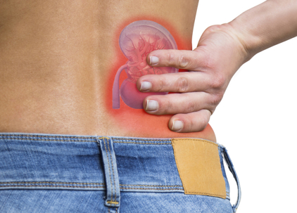 Illustration of kidney pain in the lower back area showing possible symptoms of kidney disease.