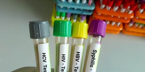 A Comprehensive Guide to Rapid STD Testing in Emergency Healthcare Photo