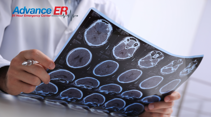Concussion Er Do You Think You Have a Concussion? You Should Go to the ER