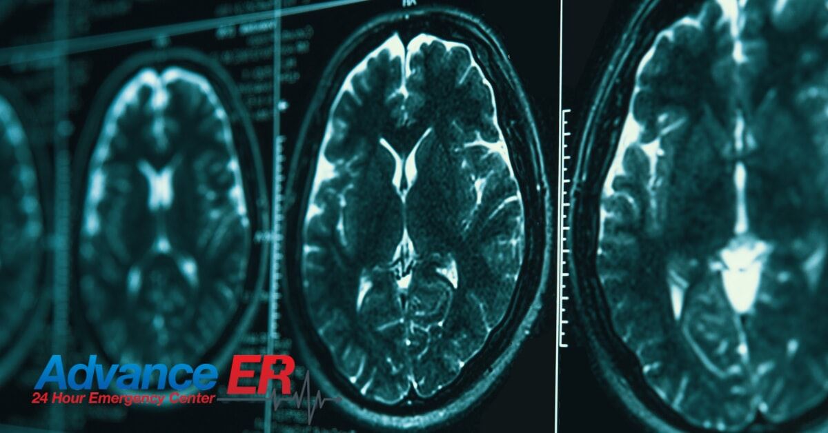 The Importance of Prompt Medical Treatment for Head Injuries